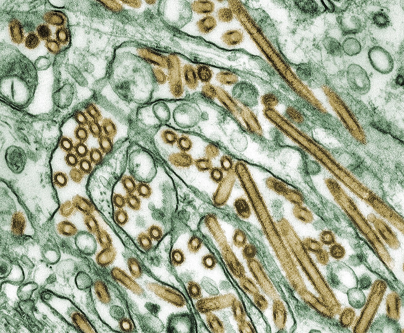 Madárinfluenzában halt meg egy nő Kínában