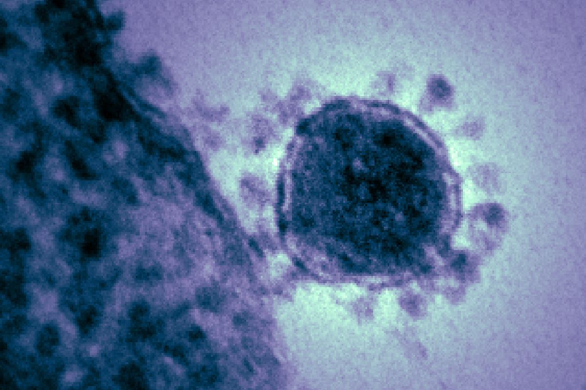 Koronavírus-gyanú az MTVA-ban