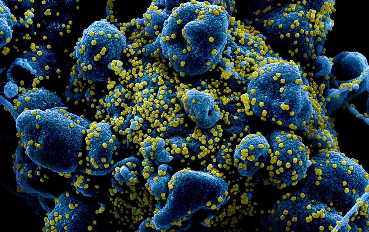 Már több mint másfélmillió ismert koronavírus-fertőzött világszerte